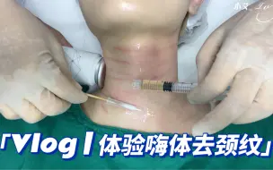 Tải video: Vlog | 体验嗨体去颈纹，好后悔，后悔没早点做！