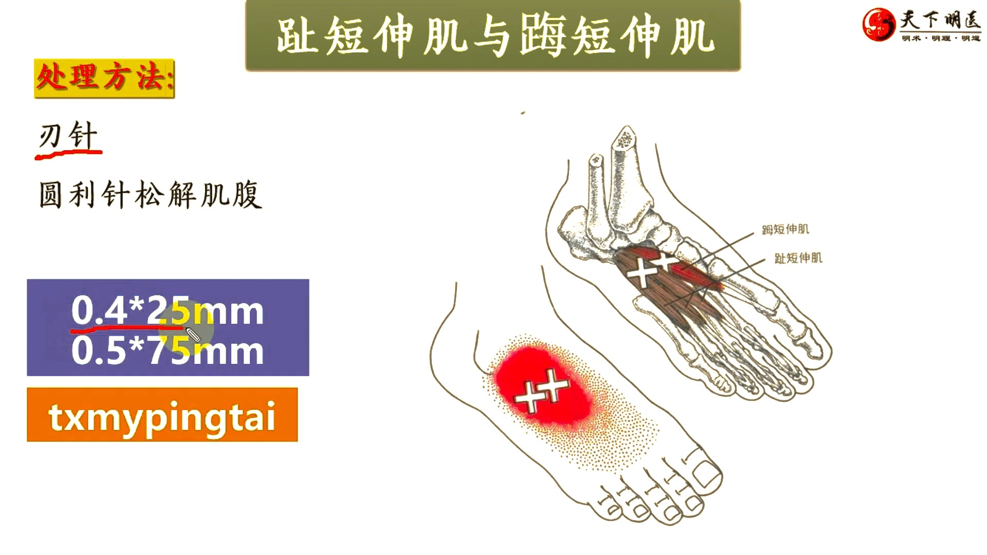 趾短屈肌起止点图片