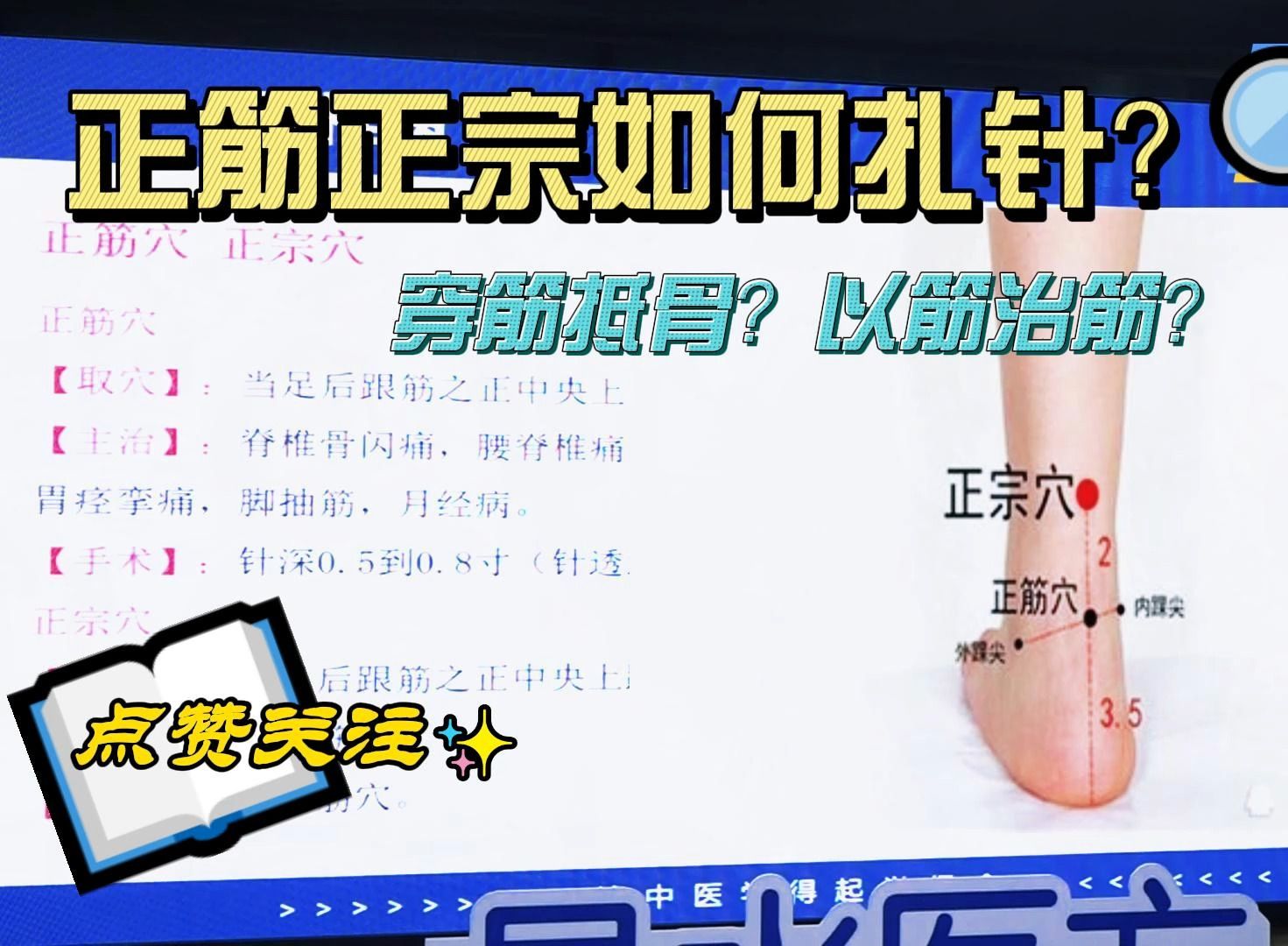 正筋正宗,到底如何下针?