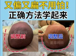 Download Video: 偏头扁头不用怕