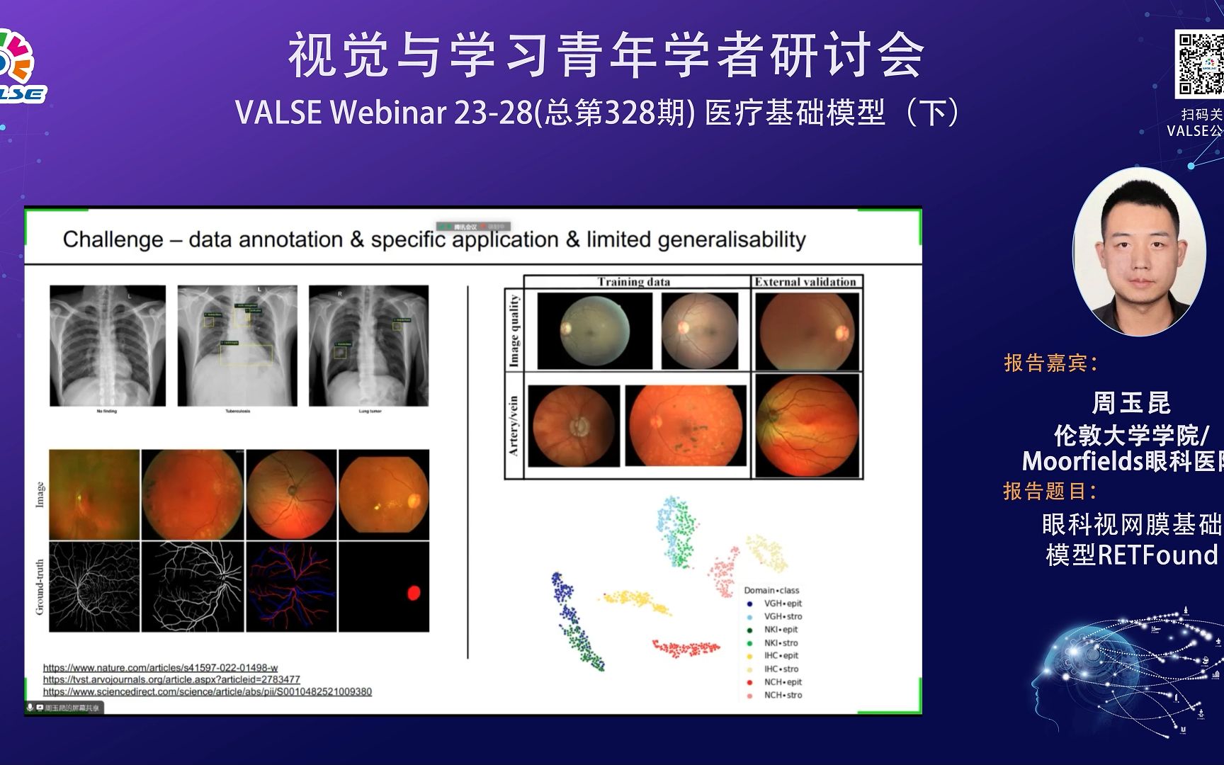 20231018【医疗基础模型 (下)】周玉昆:眼科视网膜基础模型RETFound哔哩哔哩bilibili