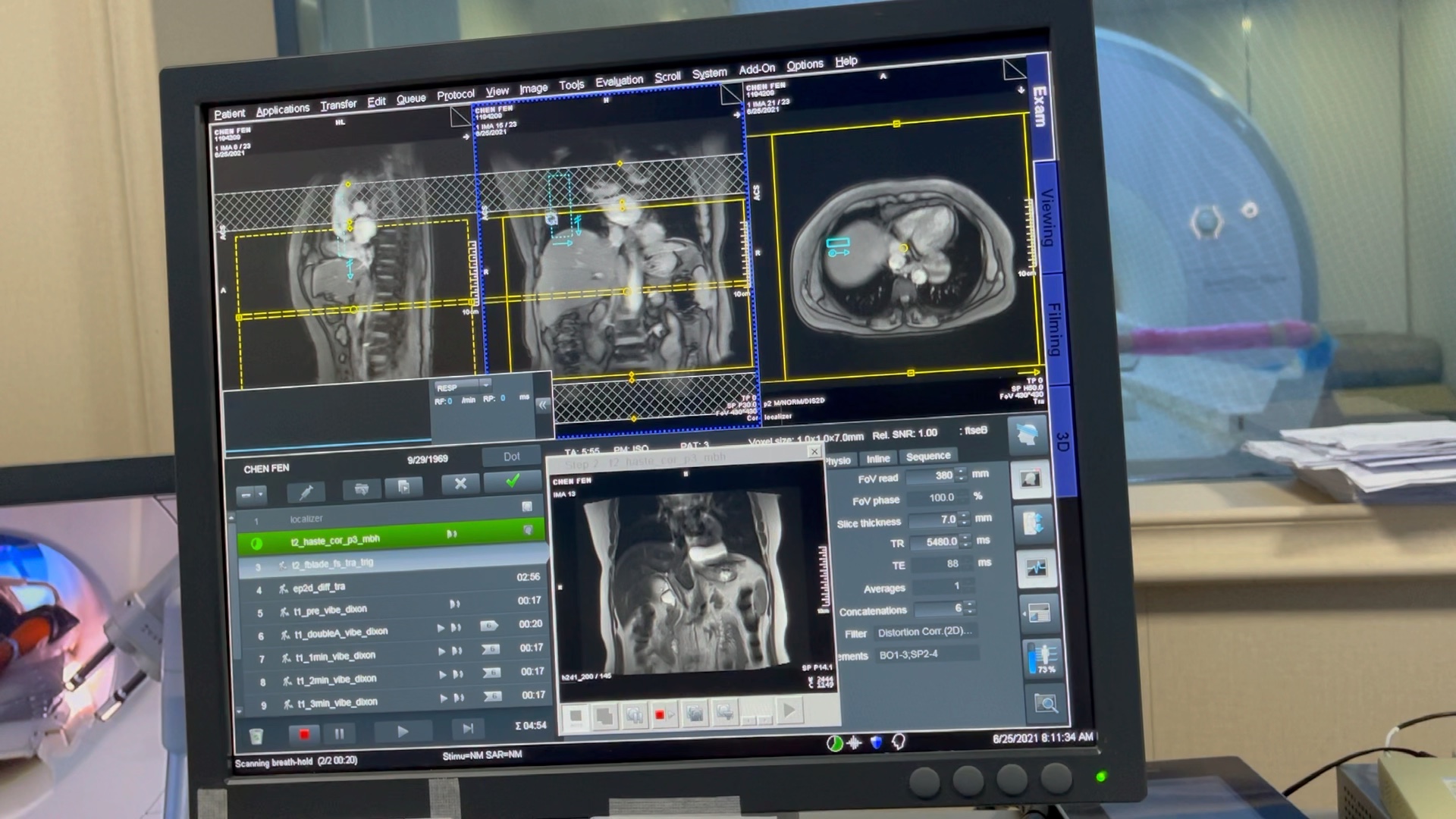 西门子磁共振肝脏mri扫描流程(新手篇)_哔哩哔哩_bilibili