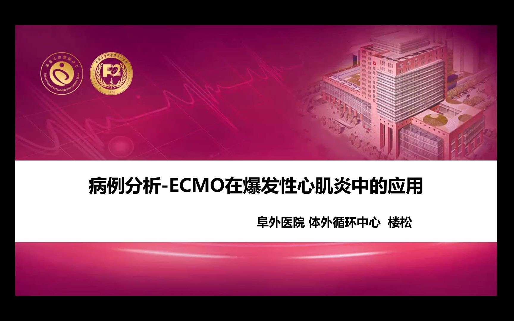 [图]ECMO概述（爆发性心肌炎病例分析+ECMO设备）