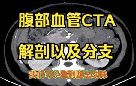 腹部血管CTA解剖以及分支哔哩哔哩bilibili