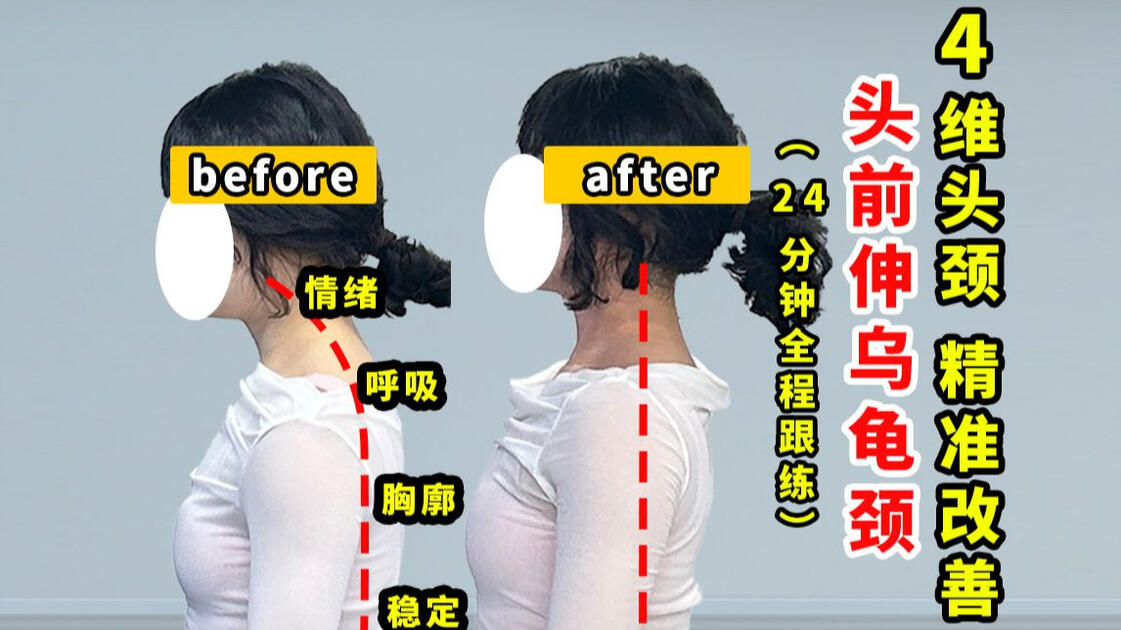 头前伸真能练好！一线体态导师带你“全程跟练”根源改善头前伸_哔哩哔哩_bilibili