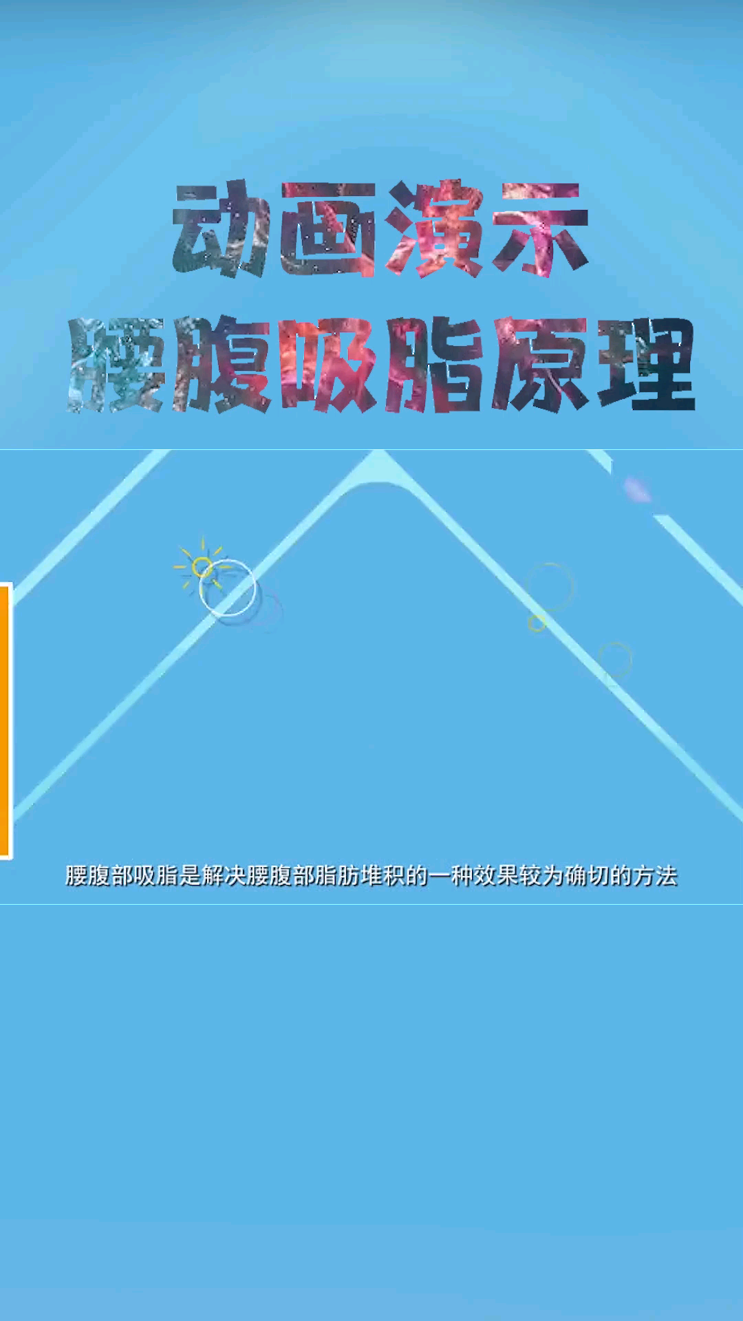 不同部位的吸脂,该如何挑选塑身衣?哔哩哔哩bilibili