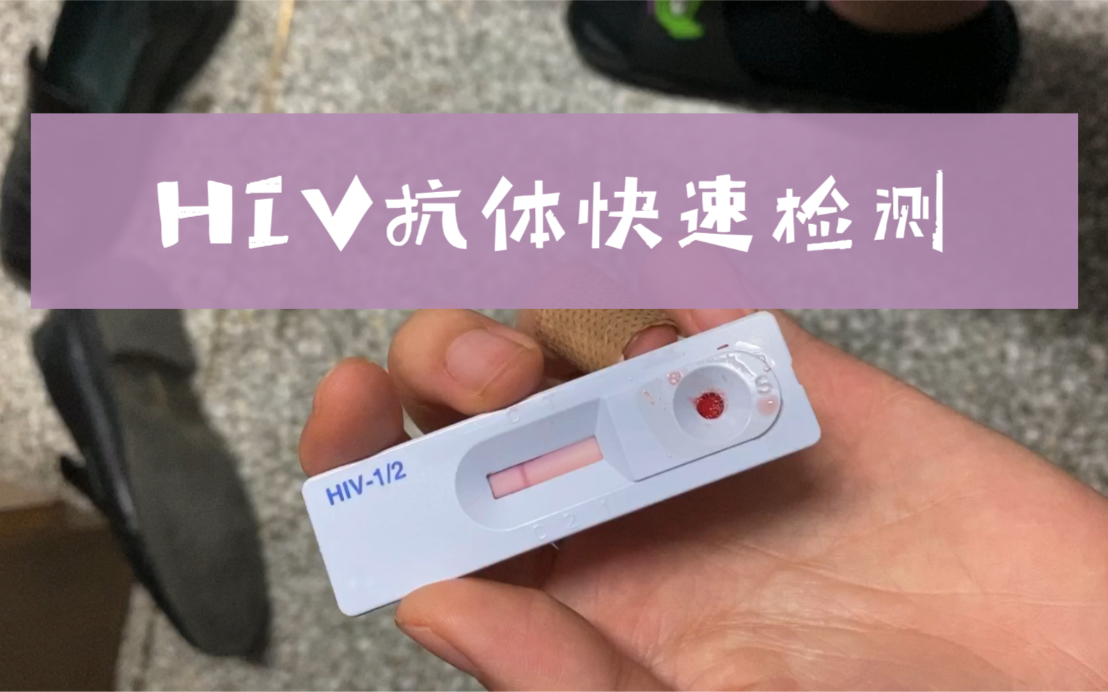 vlog9-hiv抗体快速检测