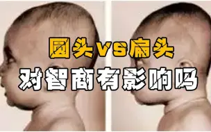 Download Video: 千万别让宝宝得“扁头综合征”如何睡出饱满的圆头？宝妈速来观看