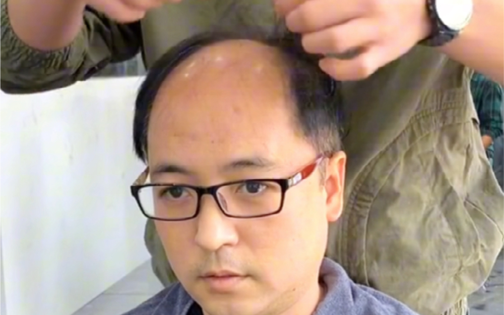 改变地中海大哥做完发型像换了个人