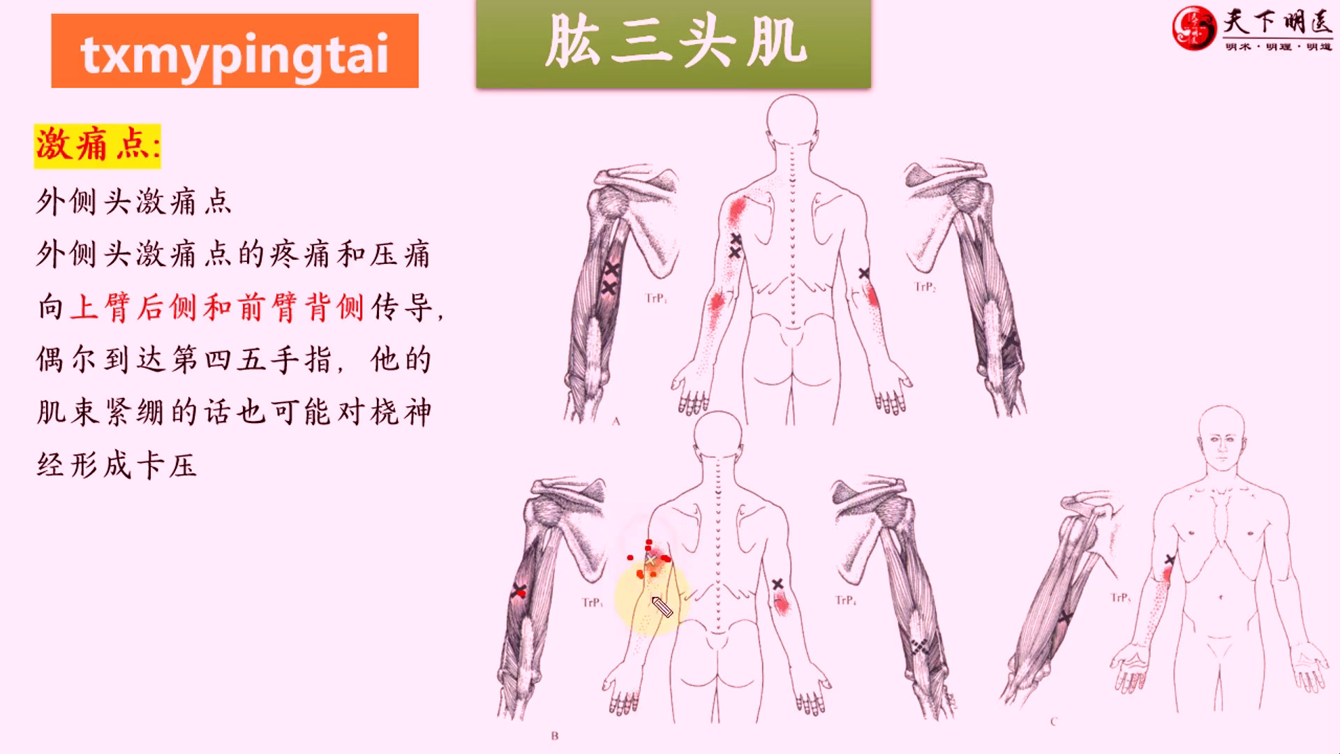 肱三头肌 3d解剖