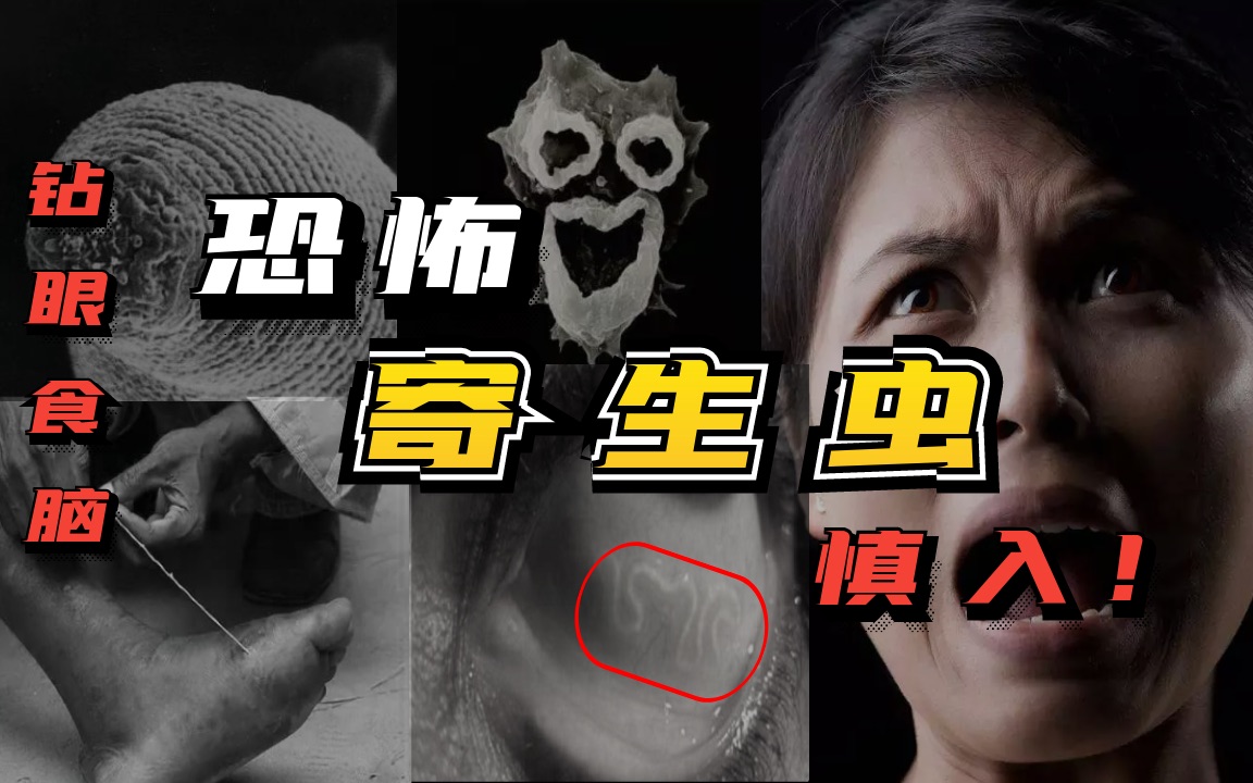 可怕的寄生虫,钻眼食脑,避开它们_哔哩哔哩_bilibili