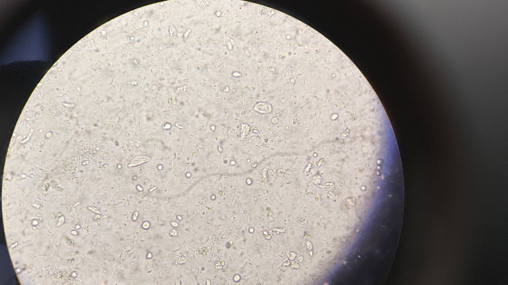 犬的滴虫感染,这是贾第鞭毛虫还是胎儿三毛滴虫?
