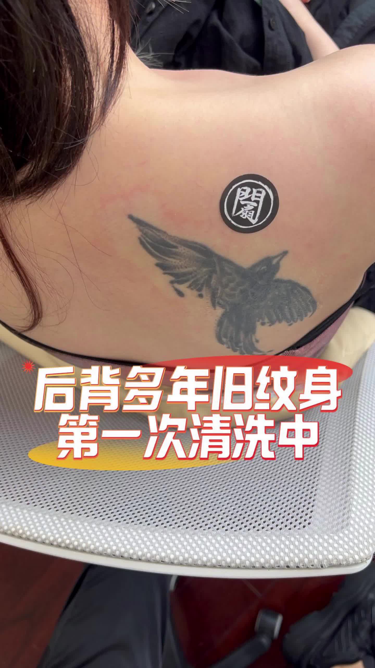 老纹身第一次清洗记录,感谢信任我们临沂一扇门,专业洗纹身