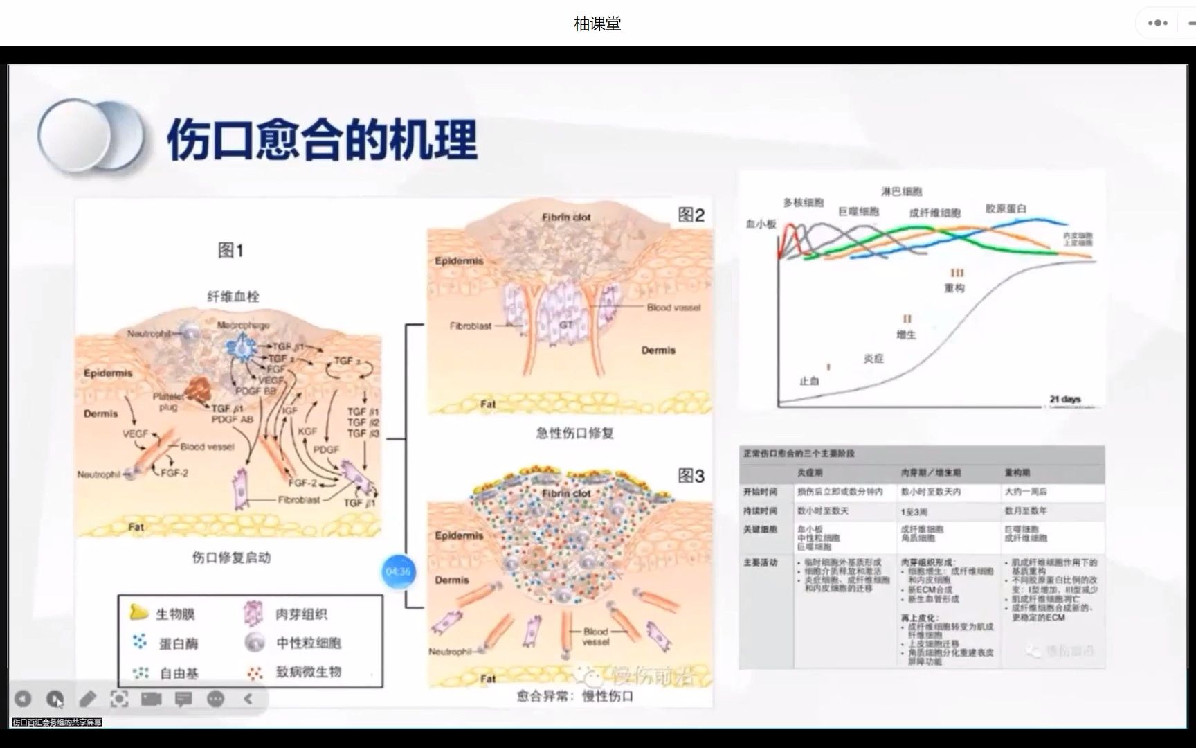 伤口常见病因2022年解放军总医院第一医学中心代永静护士长哔哩哔哩bilibili