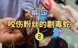 Tải video: 鉴定咬伤粉丝的毒蛇(2)老人自述被五步蛇咬伤！但其实并不是？应该用什么血清？