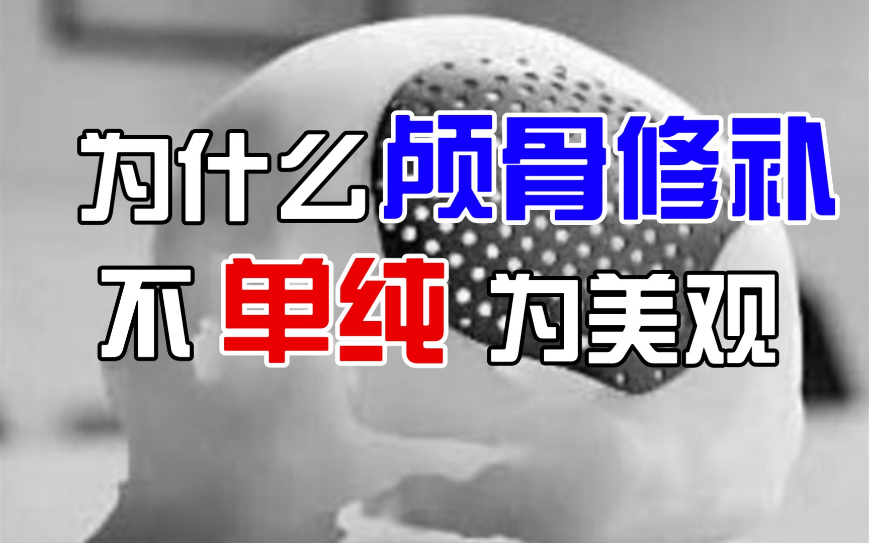 【神外手术】为什么我们要做颅骨修补?哔哩哔哩bilibili