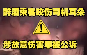 Video herunterladen: 醉酒乘车咬伤司机耳朵 涉故意伤害罪被公诉