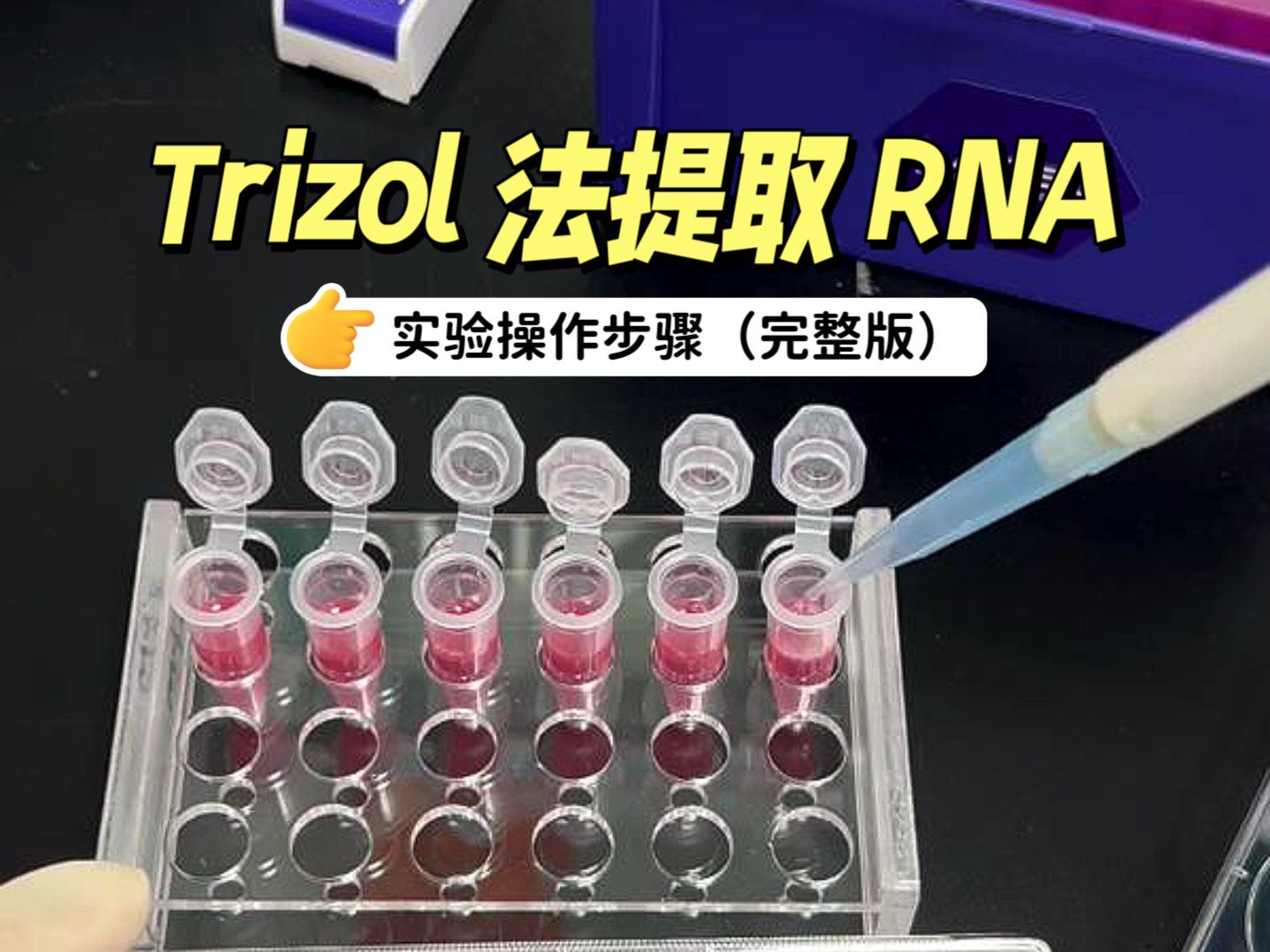 Trizol RNA Extraction: Complete Operational Steps