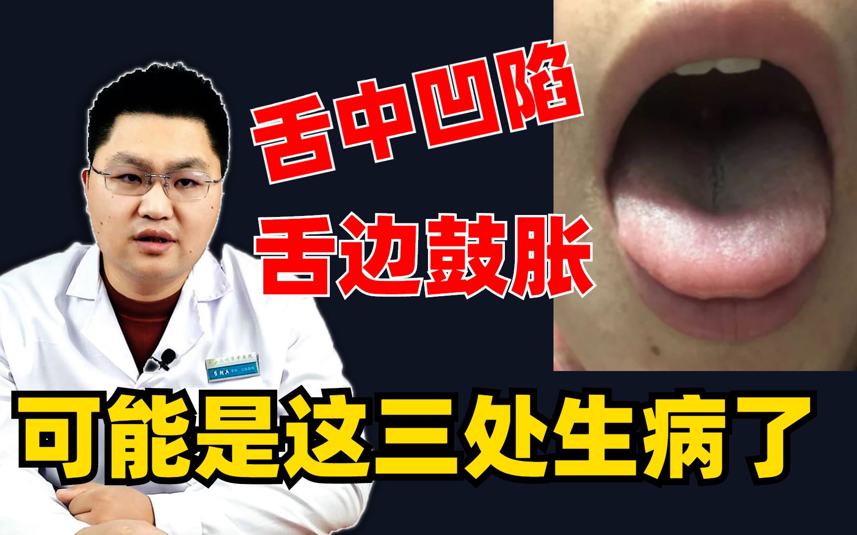 舌中凹陷,舌边鼓胀,可能是这三脏生病了,中医一次给你讲清楚 - 视频下载 Video Downloader