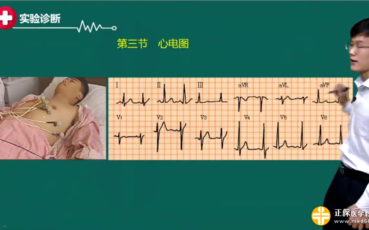 [图]教你如何看懂心电图，医学基础知识心电图