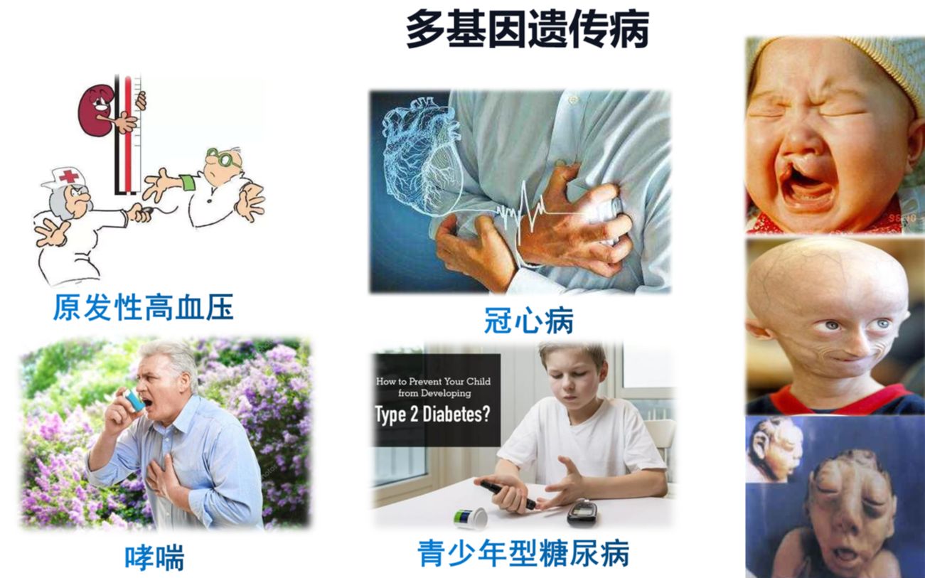 [图]【一本正经讲生物】5.3人类遗传病