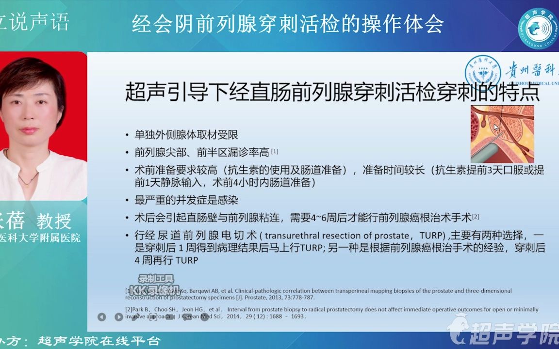 【立说声语】第31期 经会阴前列腺穿刺活检的操作体会张蓓 教授哔哩哔哩bilibili