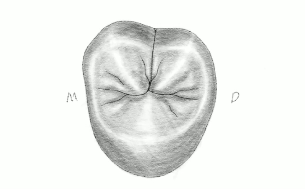 上颌第二磨牙形态素描(三尖型)哔哩哔哩bilibili