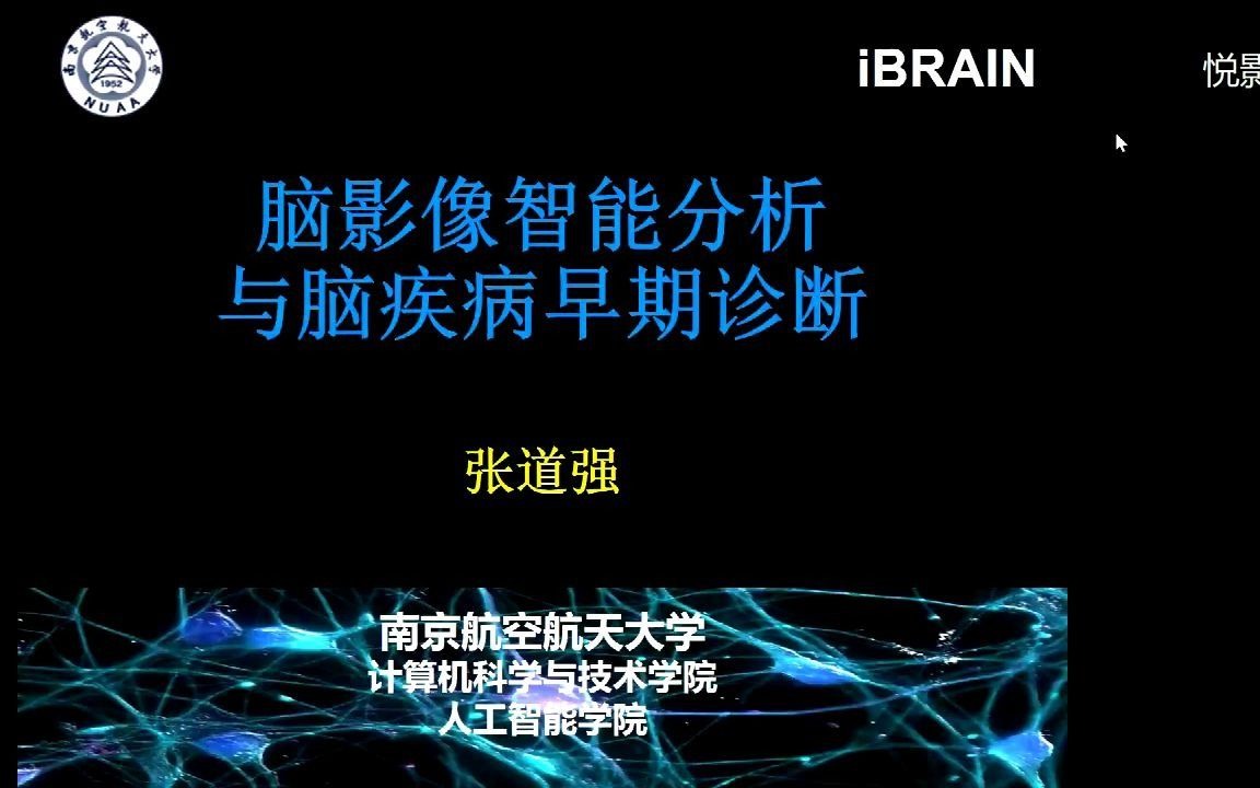 悦影科技免费讲座第3期:脑影像智能分析与脑疾病早期诊断|南京航空航天大学—张道强哔哩哔哩bilibili