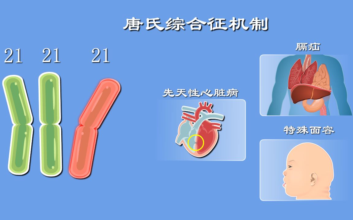 [图]唐氏综合征2：为啥娃会得唐氏综合征