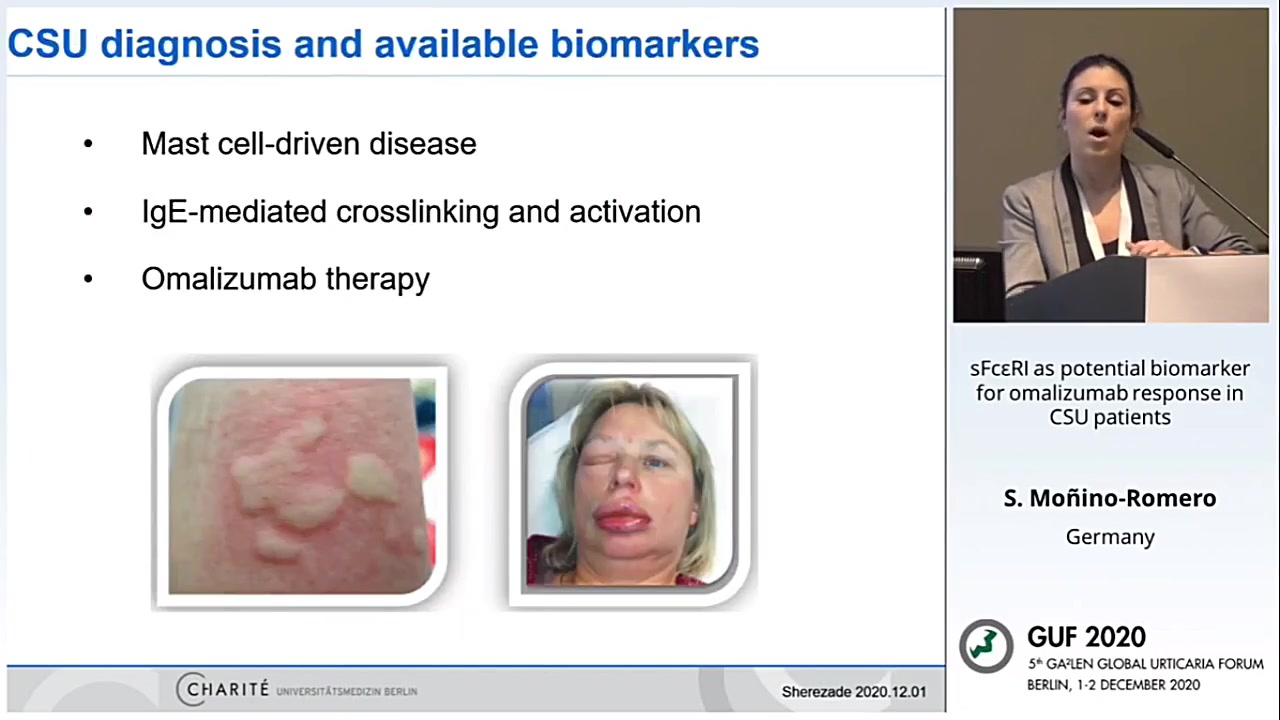 [GUF 2020]sFcI as potential biomarker for omalizumab response in CSU patients哔哩哔哩bilibili