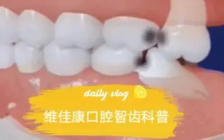 智齿长歪 搜索结果 哔哩哔哩 Bilibili