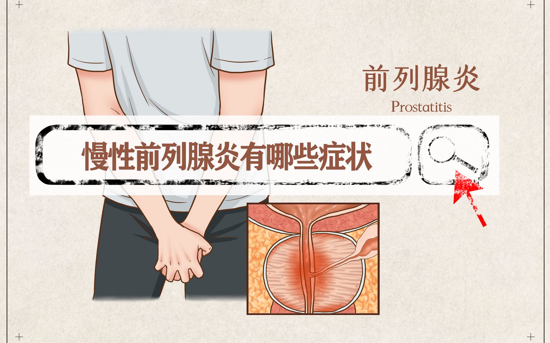 慢性前列腺炎的症状都有哪些