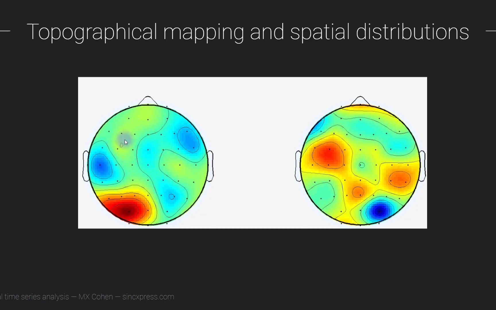 【PsyBrainEEG】5脑电地形图怎么看Topographical mapping哔哩哔哩bilibili