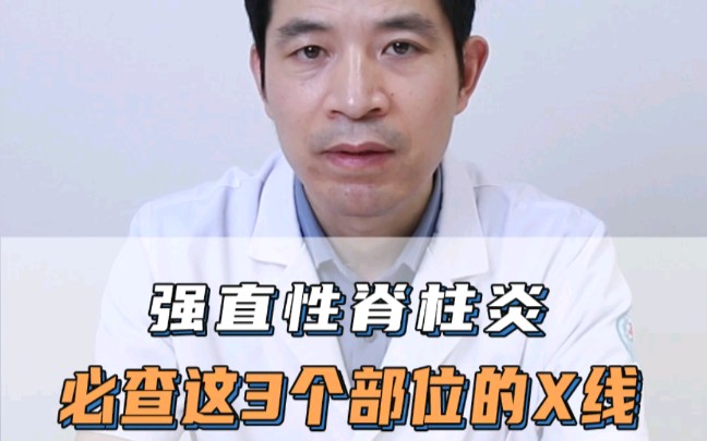 强直性脊柱炎必查这三个重点部位的X片哔哩哔哩bilibili