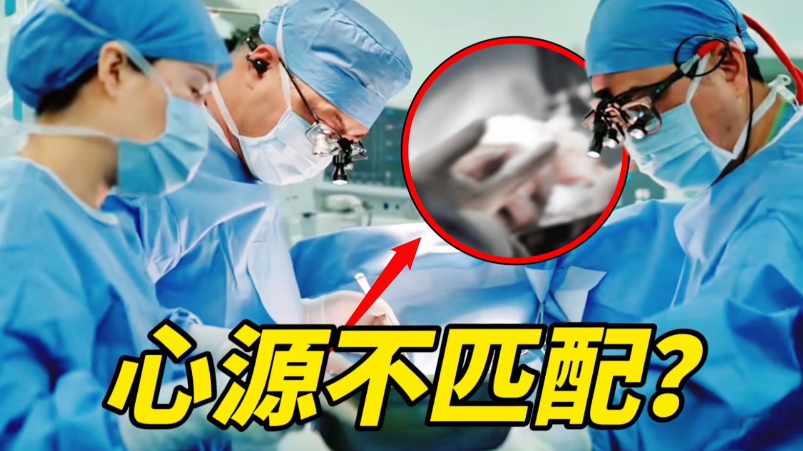 【第二次心跳】看点1：手术开始才发现供体心脏过大，主刀医生当场发飙