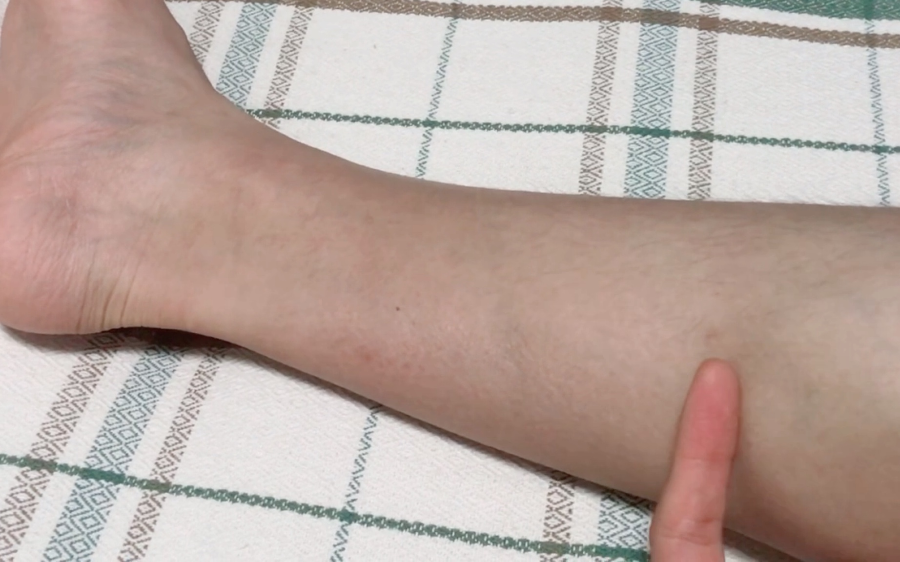 【咨询向】这个跟腱长度算短吗?