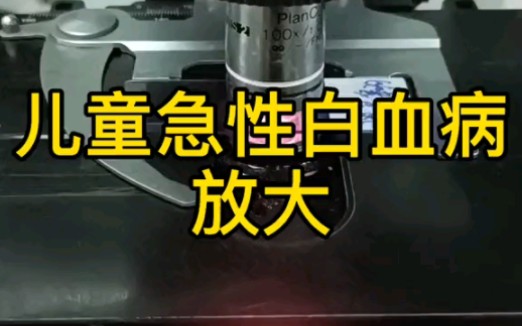 骨髓片放大哔哩哔哩bilibili