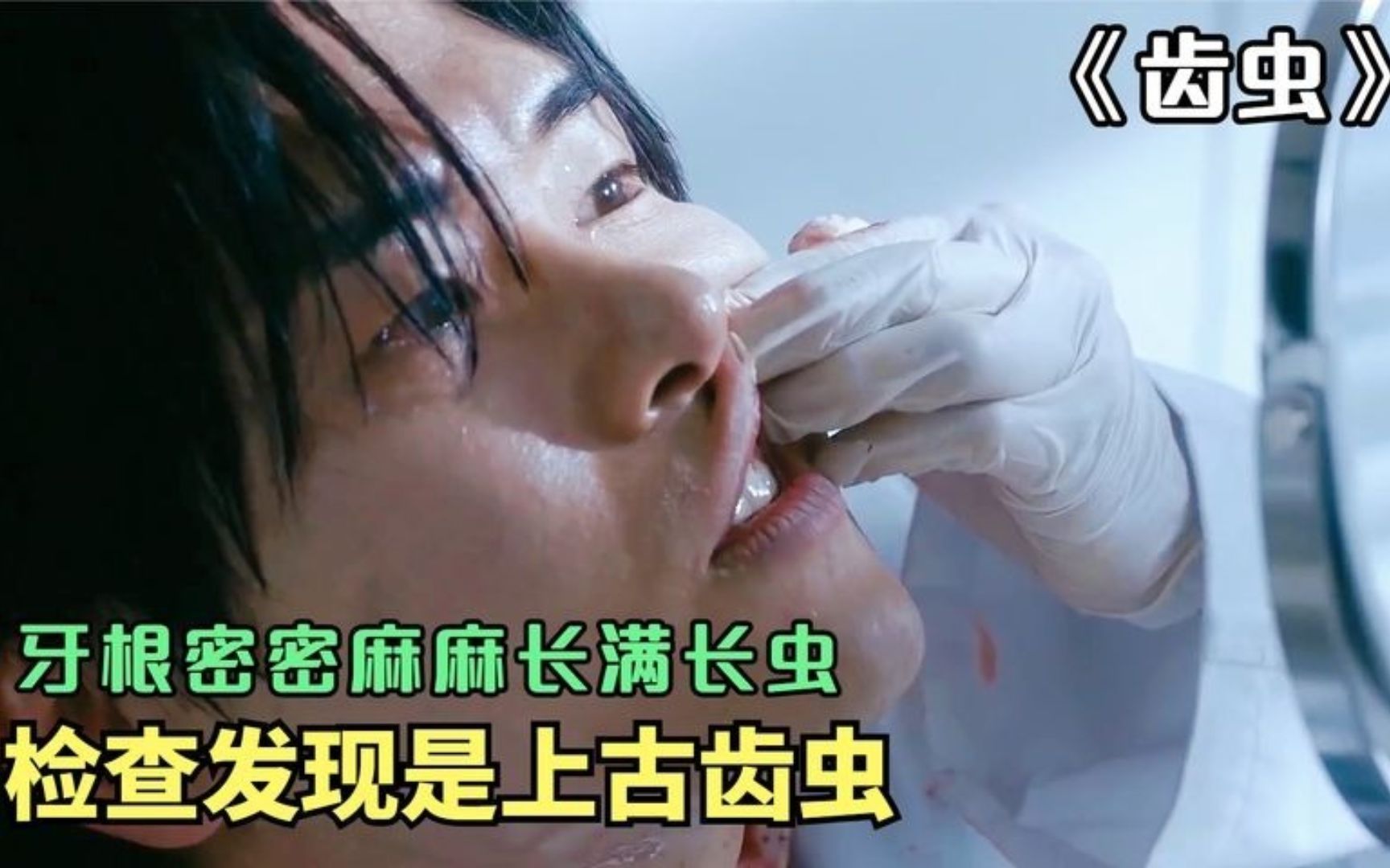 牙龈上满是蛆虫,检查后发现是上古齿虫