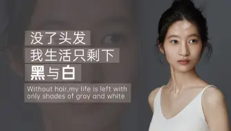 没了头发，我生活只剩下黑与白
