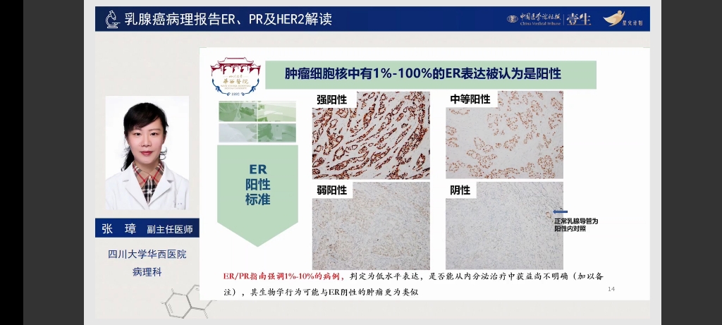 肿瘤病理基础训练营DAY4 乳腺癌病理报告ER,PR及HER2解读哔哩哔哩bilibili