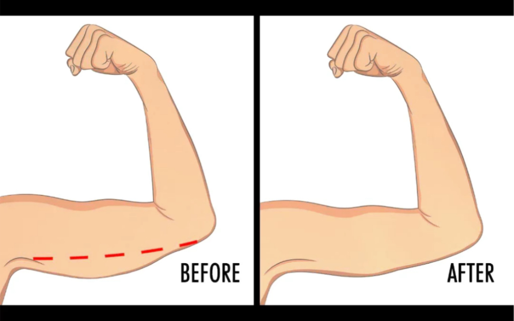 每天十分钟告别拜拜袖