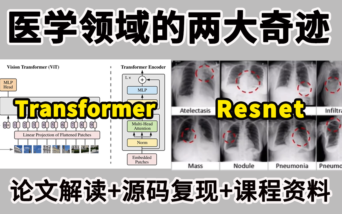 基于深度学习在医学领域的两大奇迹:Transformer+Resnet!医学分割应用与数据集分类实战!论文解读+源码复现+课程资料,绝对是医学领域的天花板!...