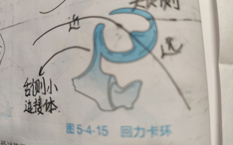 【口腔修复学】回力卡环与反回力卡环速记