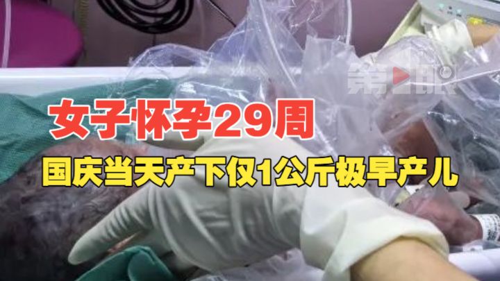 女子怀孕29周国庆当天产下仅1公斤极早产儿