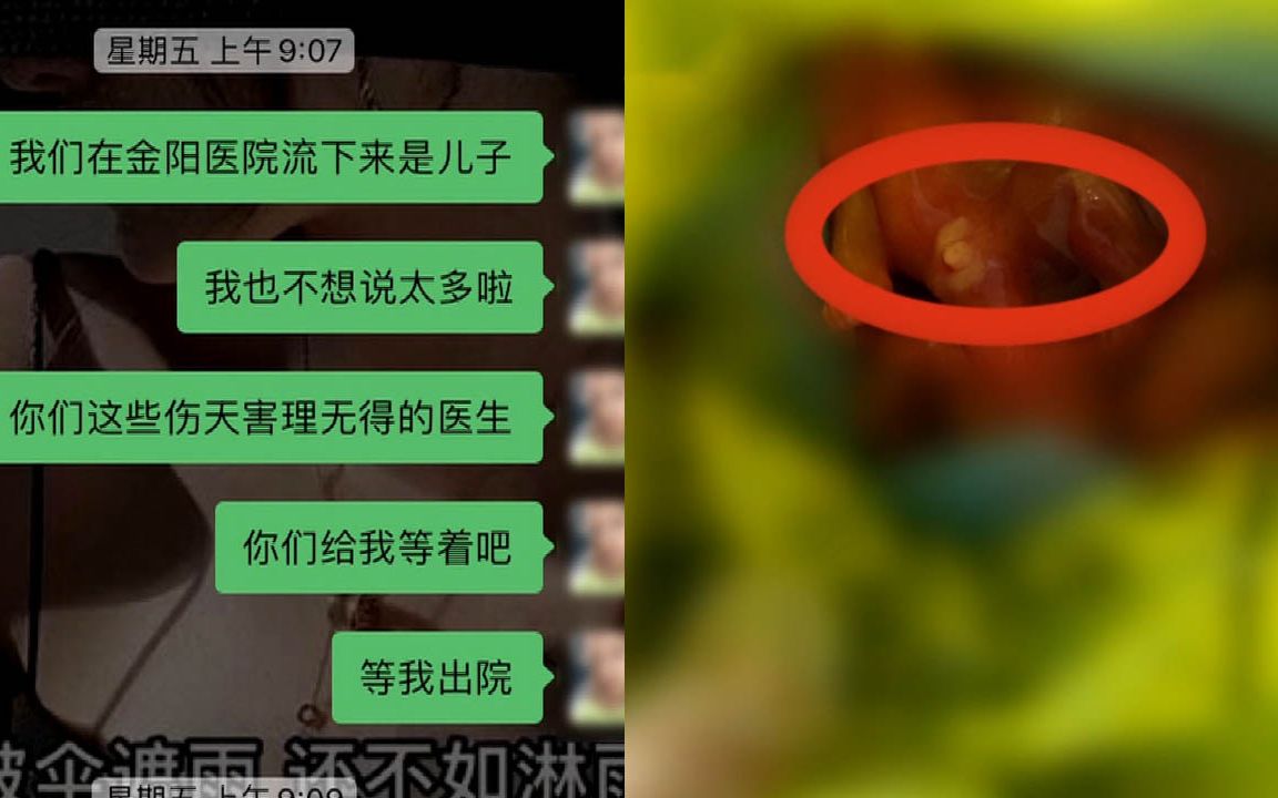 做胎兒性別鑑定,引產後卻是男孩?社區服務中心主任慌了