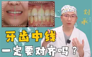 Tải video: 牙齿中线一定要对齐吗？