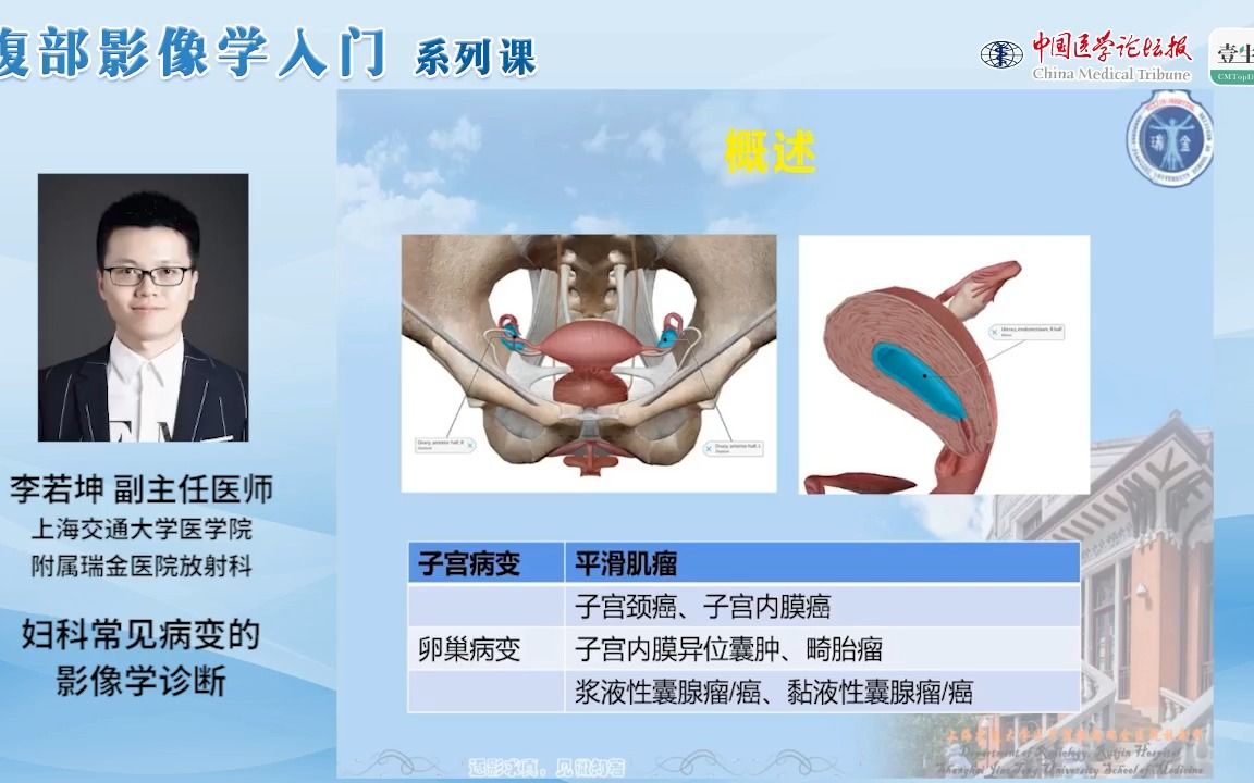 [图]【腹部影像学入门】Day29 妇科常见病变的影像学诊断