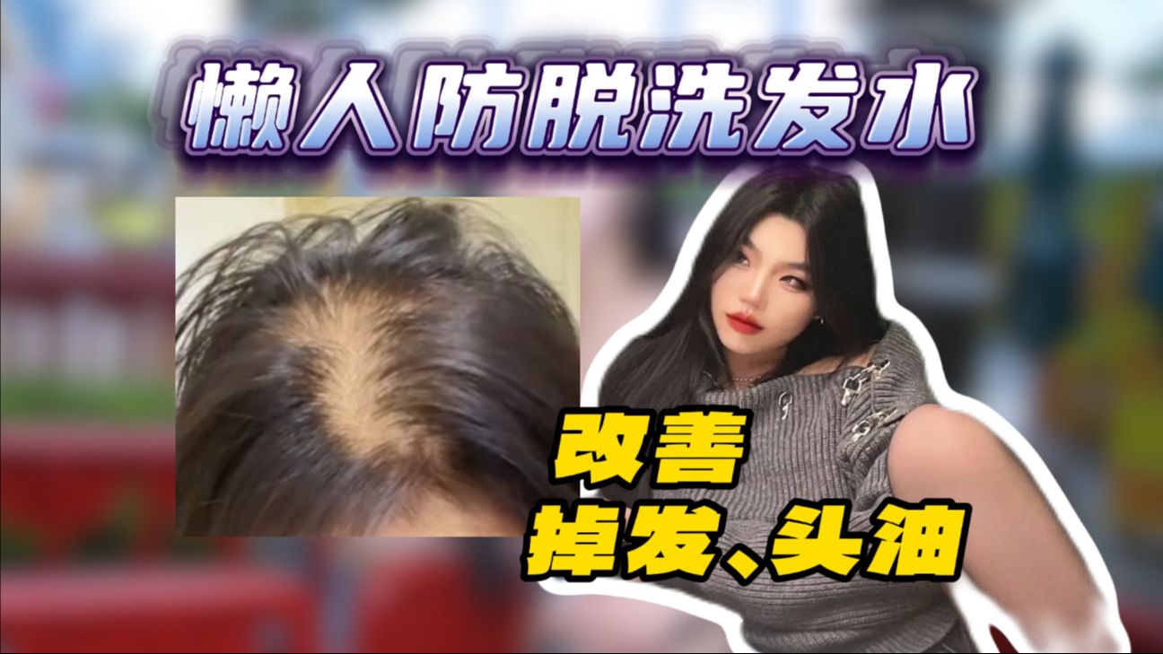 你是否也有秃头掉发的烦恼呢?一步教会你养成发量女王哔哩哔哩bilibili