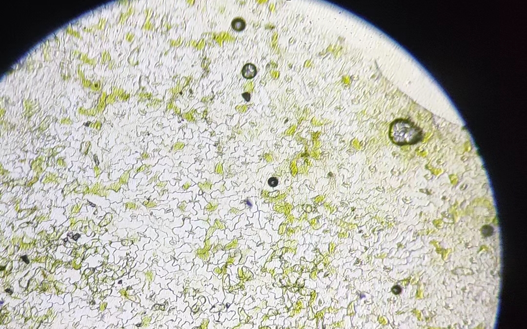 初中生物实验必看:观察叶片下表皮细胞