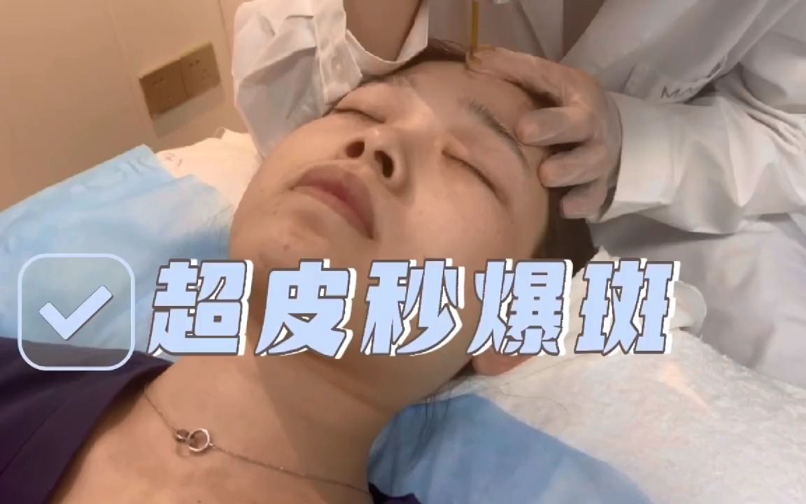 超皮秒爆破模式